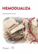 Hemodijaliza