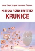 Klinička fiksna protetika - Krunice