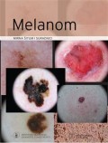 Melanom - udžbenik i atlas